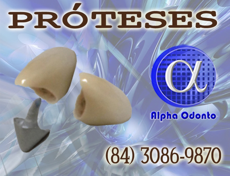 PRÓTESES DENTÁRIAS - COROAS ESTÉTICAS COM NÚCLEO - (84) 3086-9870